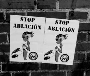 stop ablacion